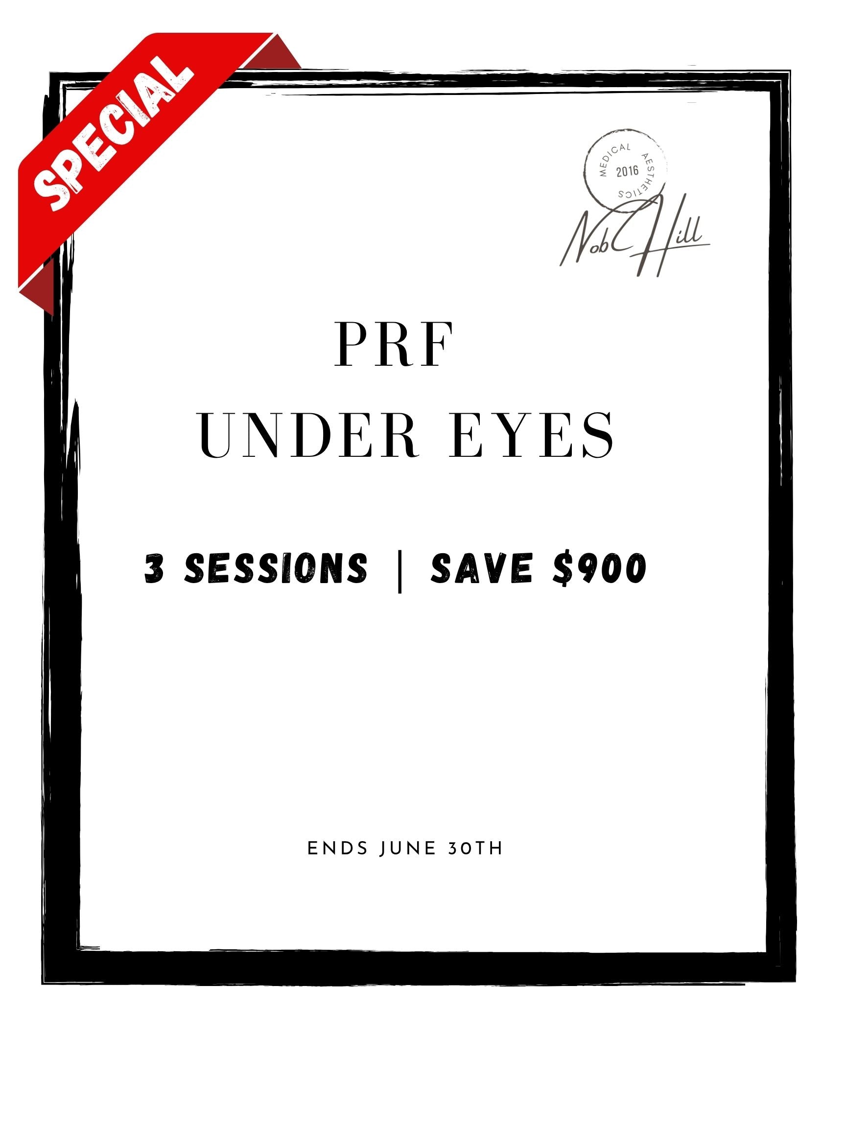 Summer Sale: PRF Under Eyes