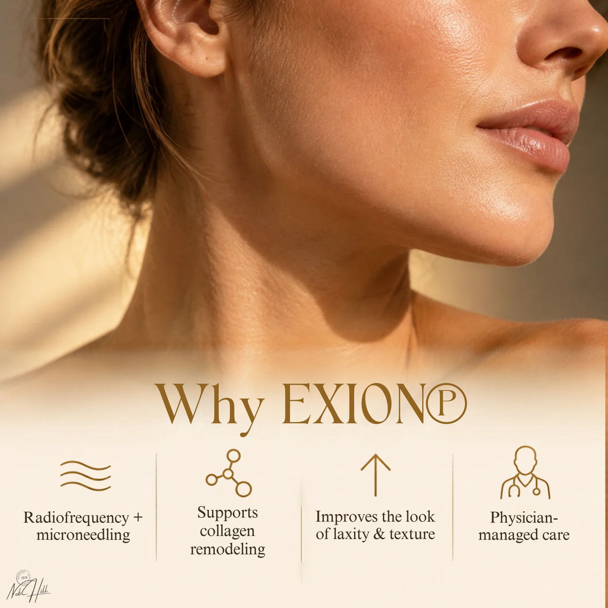 EXION® RF Microneedling | Black Friday Package